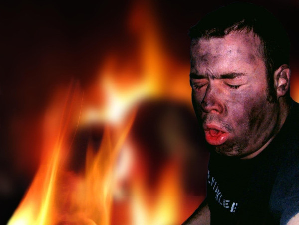 Akut Duman İnhalasyonu